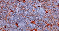 Proton therapy clinical trial to begin